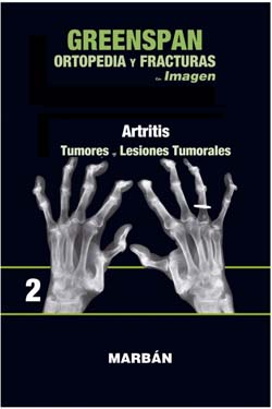 2 Artritis Tumores y Lesiones Tumorales