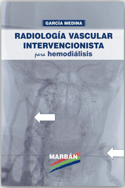 Radiología Vascular Intervencionista para Hemodiálisis