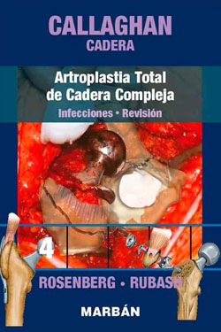 4 Callaghan Cadera Artroplastia Total de Cadera Compleja