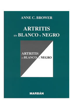 Artritis en Blanco y Negro