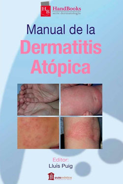 Manual de la Dermatitis Atópica