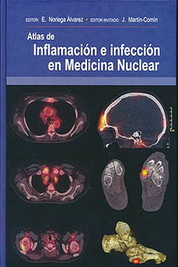 Atlas de Inflamación e Infección en Medicina Nuclear