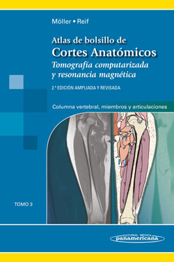 Atlas de Bolsillo de Cortes Anatómicos Columna Vertebral, Miembros y Articulaciones T. 3