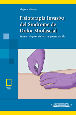 Fisioterapia Invasiva del Síndrome de Dolor Miofascial + Ebook