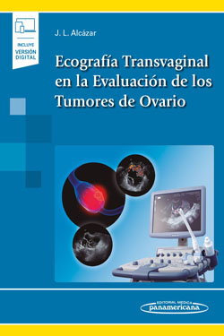 Ecografía Transvaginal en la Evaluación de los Tumores de Ovario + Ebook
