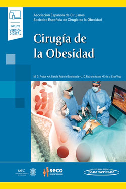 Cirugía de la Obesidad + Ebook