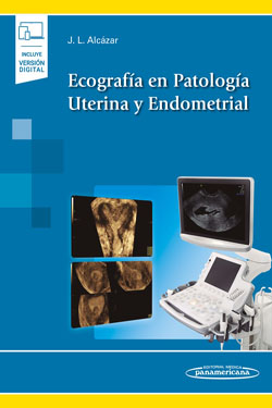 Ecografía en Patología Uterina y Endometrial + Ebook