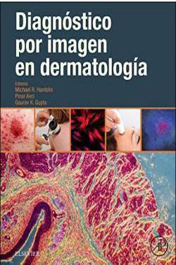 Diagnóstico por Imagen en Dermatología