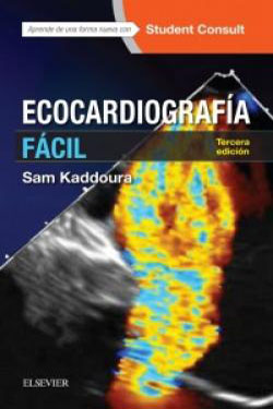 Ecocardiografía Fácil