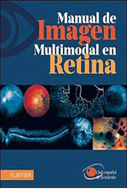 Manual de Imagen Multimodal en Retina