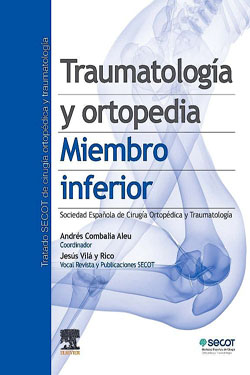 Traumatología y Ortopedia Miembro Inferior SECOT Tomo 3