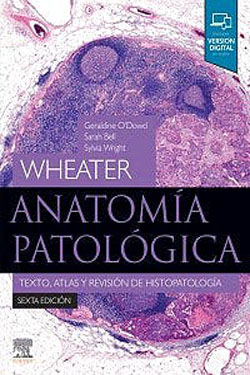 WHEATER Anatomía Patológica