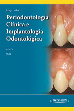 Periodontología Clínica e Implantología Odontológica T. 2