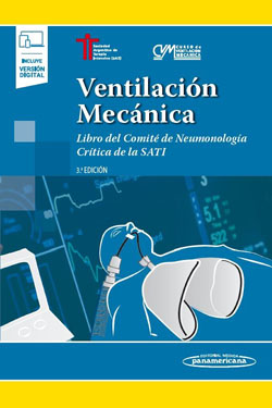 Ventilación Mecánica + Ebook