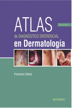 Atlas de Diagnóstico Diferencial en Dermatología