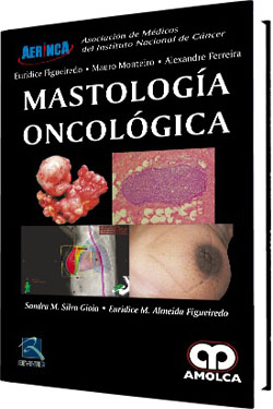 Mastología Oncológica