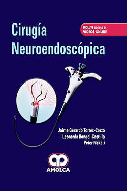 Cirugía Neuroendoscópica