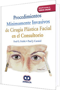 Procedimientos Mínimamente Invasivos de Cirugía Plástica Facial en el Consultorio