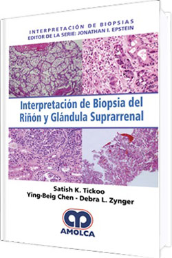 Interpretación de Biopsias del Riñon y Glándula Suprarrenal
