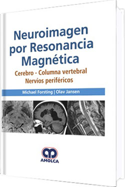 Neuroimagen por Resonancia Magnética