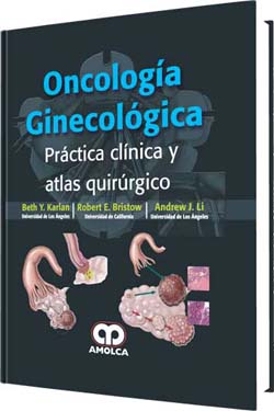 Oncología Ginecológica