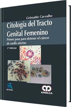 Citología del Tracto Genital Femenino