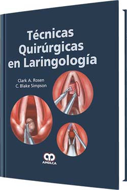 Técnicas Quirúrgicas en Laringología