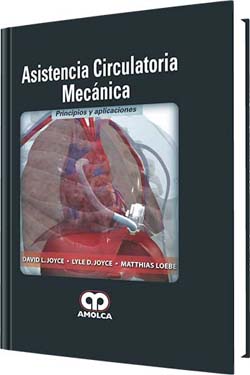 Asistencia Circulatoria Mecánica