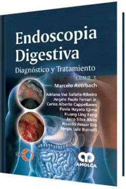 Endoscopia Digestiva 2 Ts.