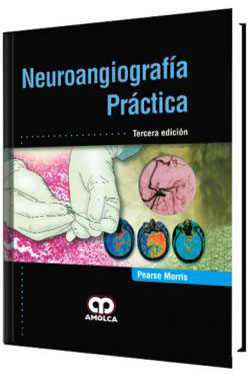 Neuroangiografía Práctica