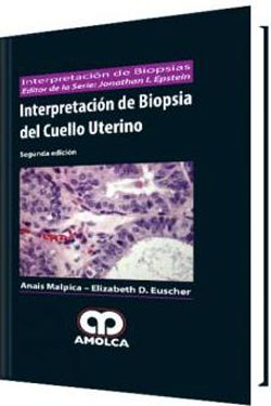 Interpretación de Biopsia del Cuello Uterino