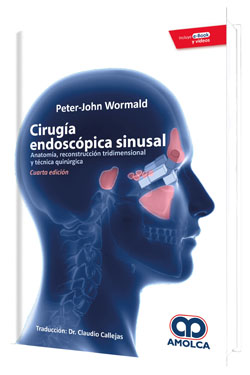 Cirugía Endoscópica Sinusal