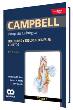 Campbell Ortopedia Quirúrgica T 6