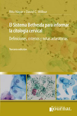 El Sistema Bethesda para Informar la Citología Cervical