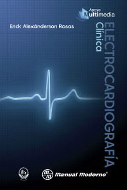 Electrocardiografía Clínica
