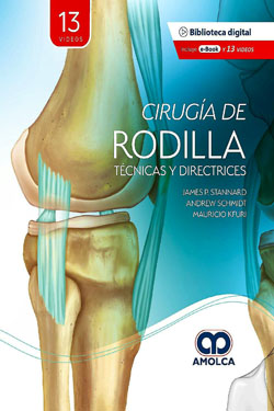 Cirugía de Rodilla