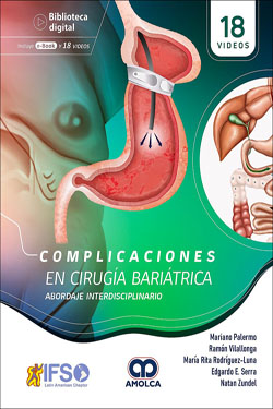 Complicaciones en Cirugía Bariátrica