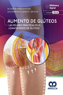 Aumento de Glúteos