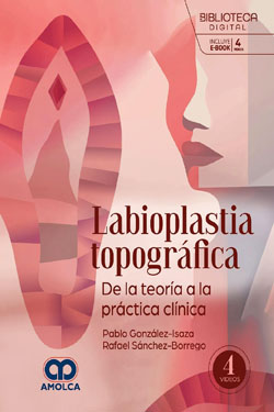 Labioplastia Topográfica