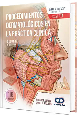 Procedimientos Dermatológicos en la Práctica Clínica