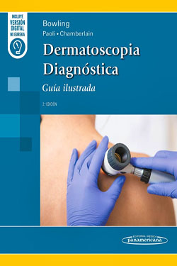 Dermatoscopia Diagnóstica