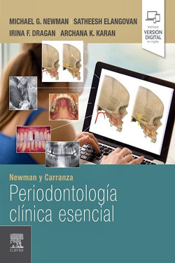 NEWMAN y CARRANZA Periodontología Clínica Esencial