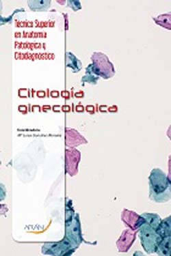 Citología Ginecológica