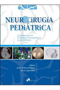 Neurocirugía Pediátrica