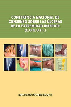 Conferencia Nacional de Consenso Sobre las Úlceras de la Extremidad Inferior