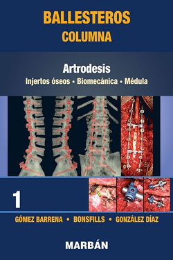 1 Ballesteros Columna Artrodesis - Reimp