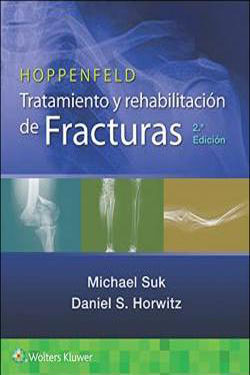 HOPPENFELD Tratamiento y Rehabilitación de Fracturas
