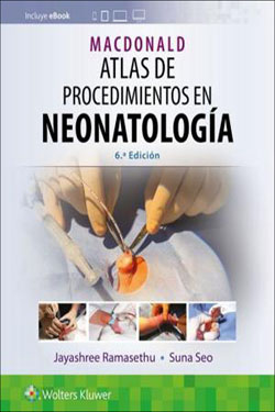 MACDONAL Atlas de Procedimientos en Neonatología