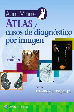 AUNT MINNIE Atlas y Casos de Diagnóstico por Imagen