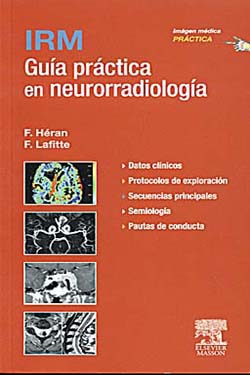 IRM Guía Práctica en Neurorradiología